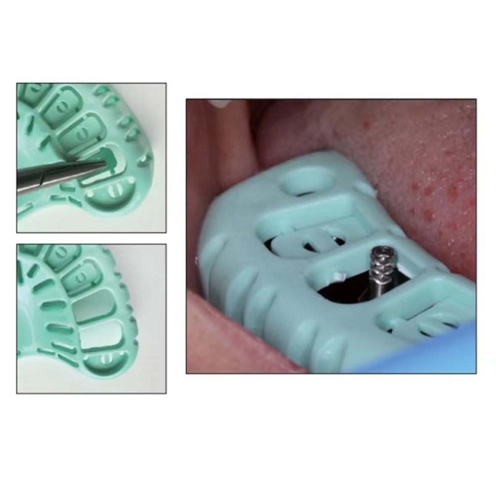 FULAIGE ชุดถาดพิมพ์ฟันแบบใช้แล - Dental Impression Material Kit บทวิจารณ์และราคา
