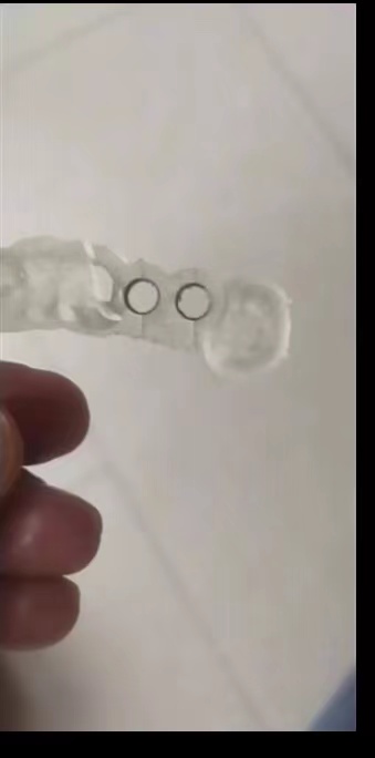 คู่มือการปลูกเครื่องพิมพ์ 3D ท - Dental 3D Printer Resin บทวิจารณ์และราคา