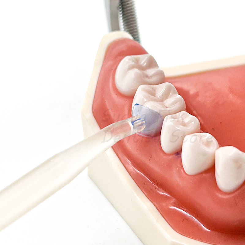 100 ชิ้น/เซ็ต Dental Matrix สี - Dental Impression Material Kit บทวิจารณ์และราคา