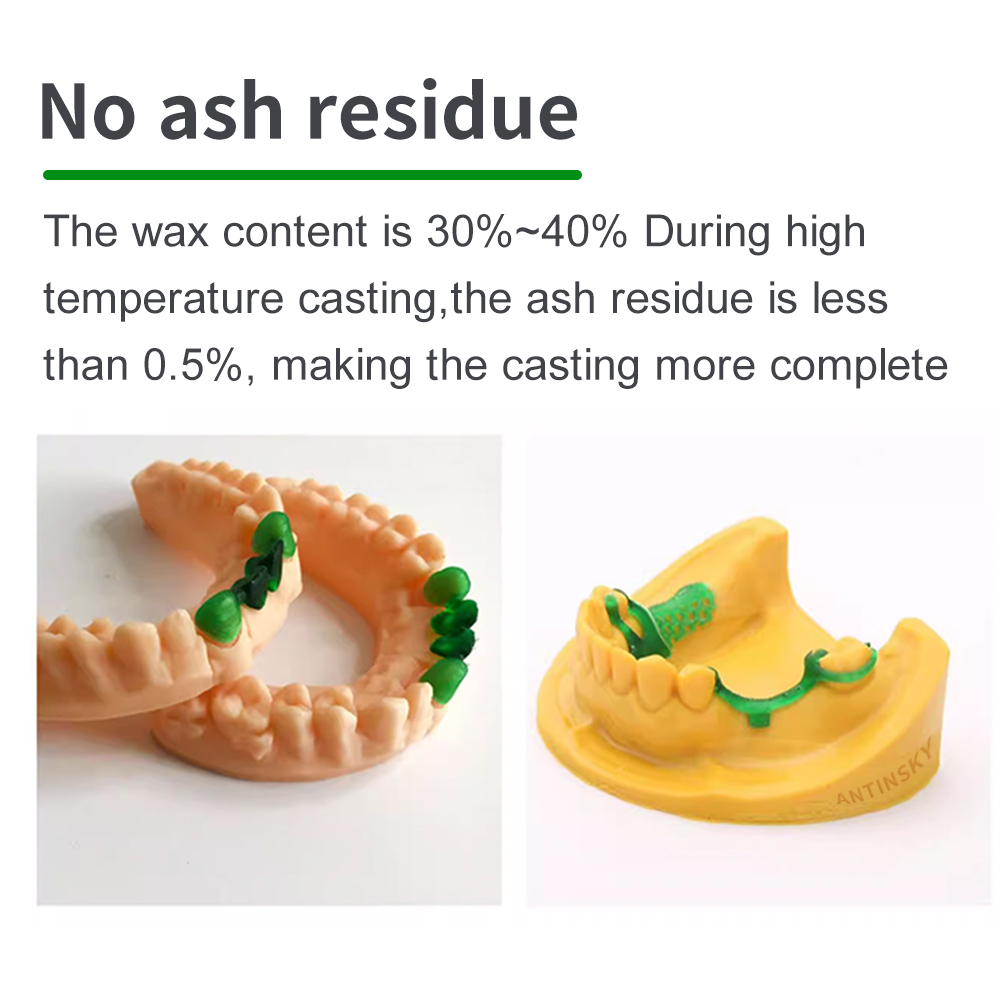 เรซิ่นสำหรับงานทันตกรรม Antins - Dental 3D Printer Resin บทวิจารณ์และราคา