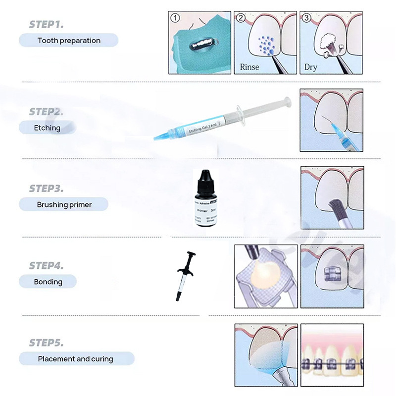 ชุดอุปกรณ์กาวติดเครื่องมือจัดฟ - Dental Impression Material Kit บทวิจารณ์และราคา